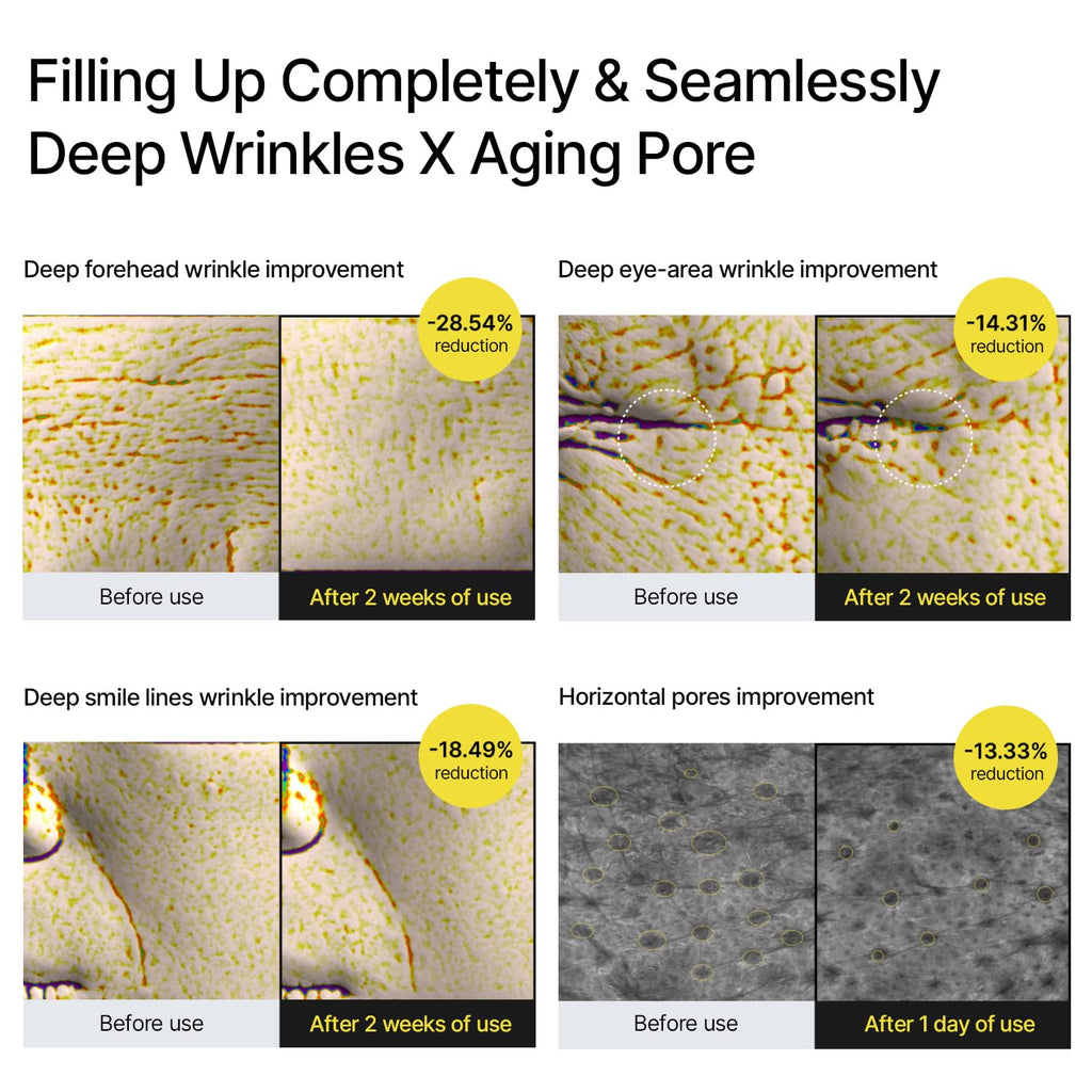 the Vita a Retinal Shot Tightening Booster | 0.1% Retinal, 3% Matryxyl, High-Strength Retinoid for Anti-Aging, Pore Minimizer, Wrinkles & Fine Lines, Firmer Skin, 15Ml